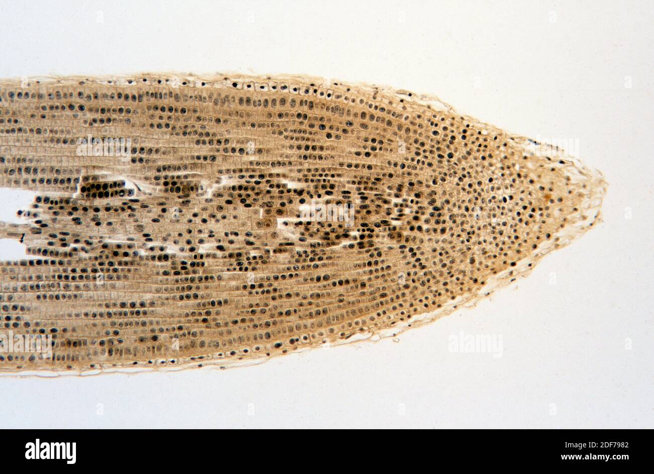 Calyptra or root cap protecting meristematic tissue of onion root