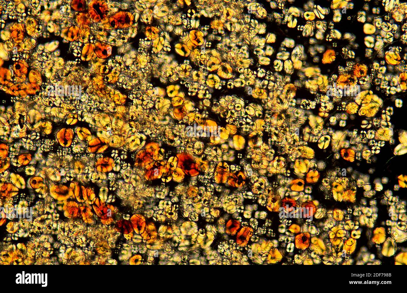 Amyloplasts or starch grains on a reserve parenchyma. Photomicrograph ...