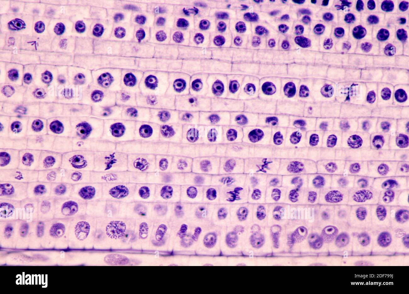 Mitosis Stages Under Microscope