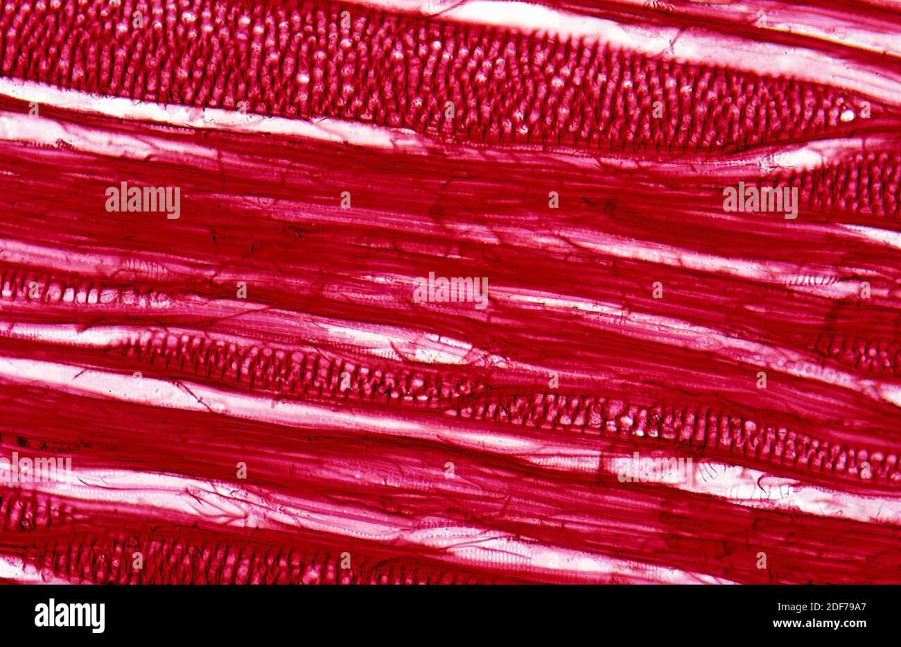 Tracheids are a kind of xylem. Photomicrograph, longitudinal section of gymnosperm. Stock Photo