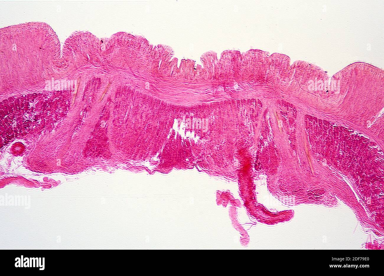 Oligochaeta cross section showing cuticle, longitudinal muscles and chaetae (yellow). Photomicrograph. Stock Photo