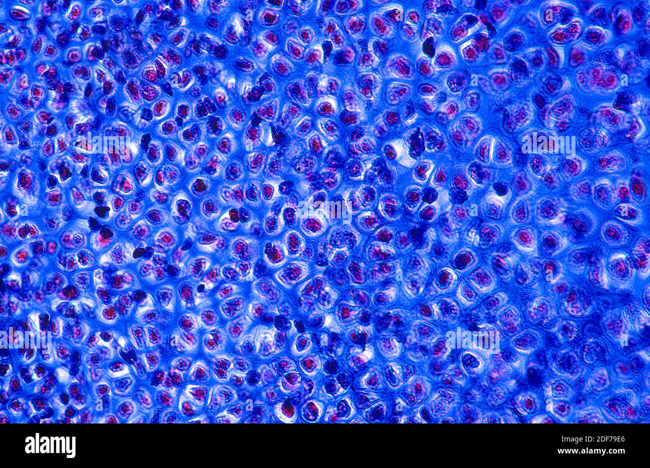 Hyaline cartilage is a kind of cartilage tissue. Photomicrograph. Stock Photo