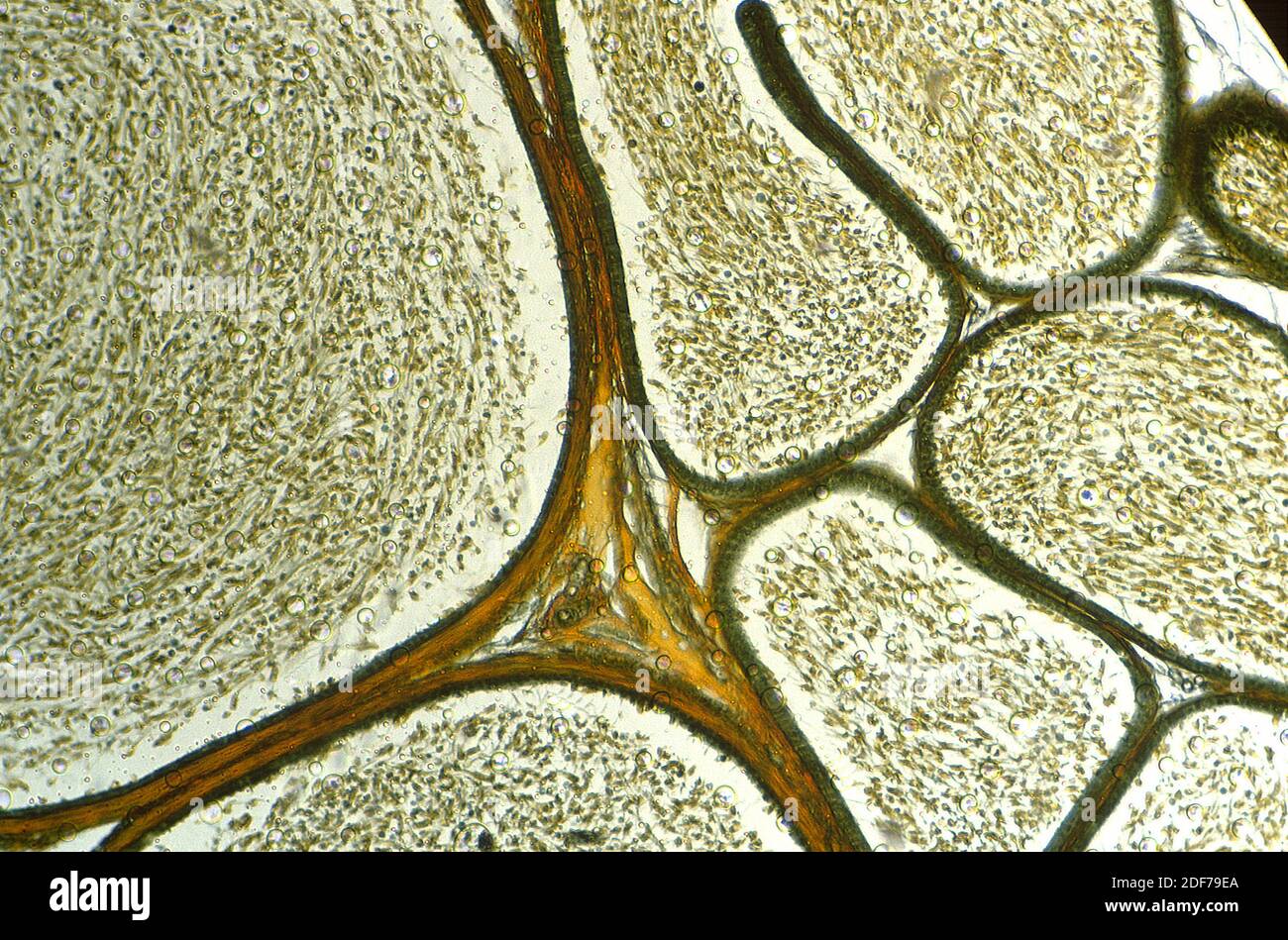 Guinea pig testicle showing seminiferous tubules and spermatozoa