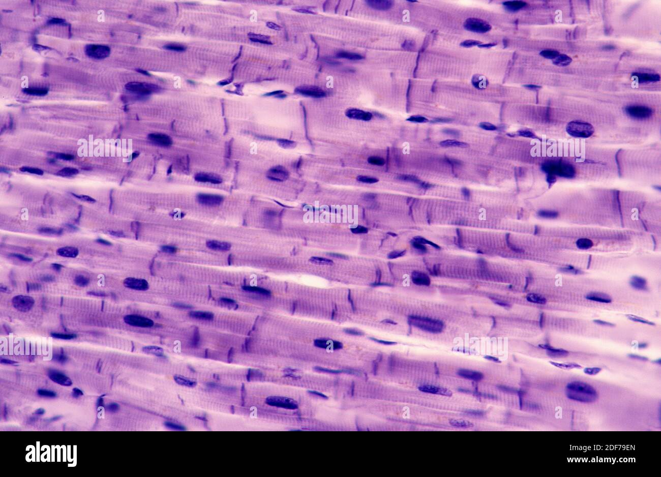 Cardiac muscle showing cells, nucleous and sarcomeres. Photomicrograph. Stock Photo