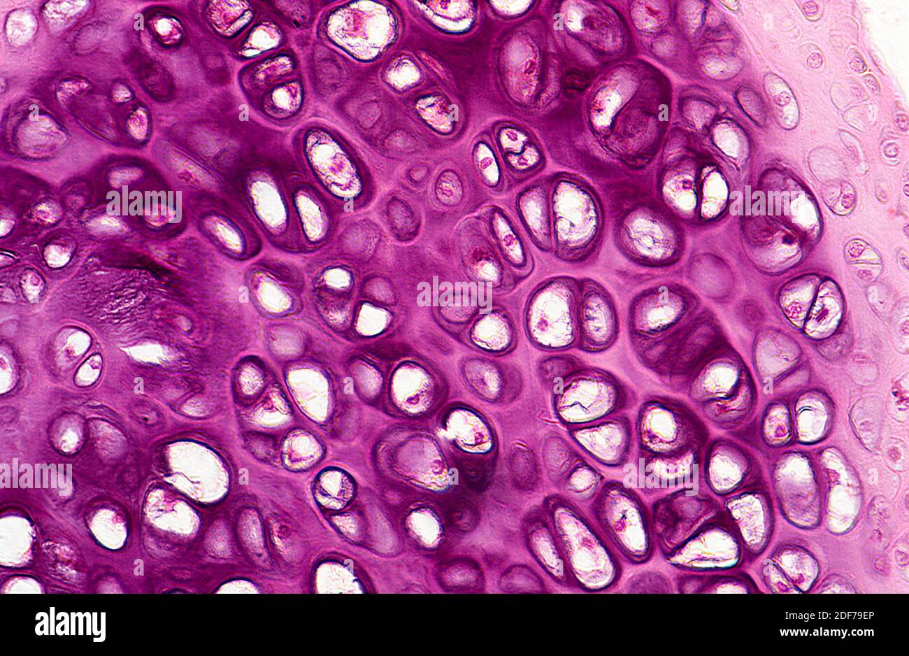 Cartilage section showing chondrocytes, lacunae and matrix. Photomicrograph. Stock Photo
