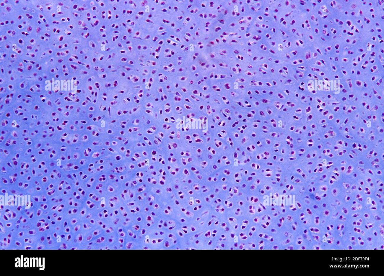 Hyaline cartilage is a kind of cartilage tissue. Photomicrograph Stock