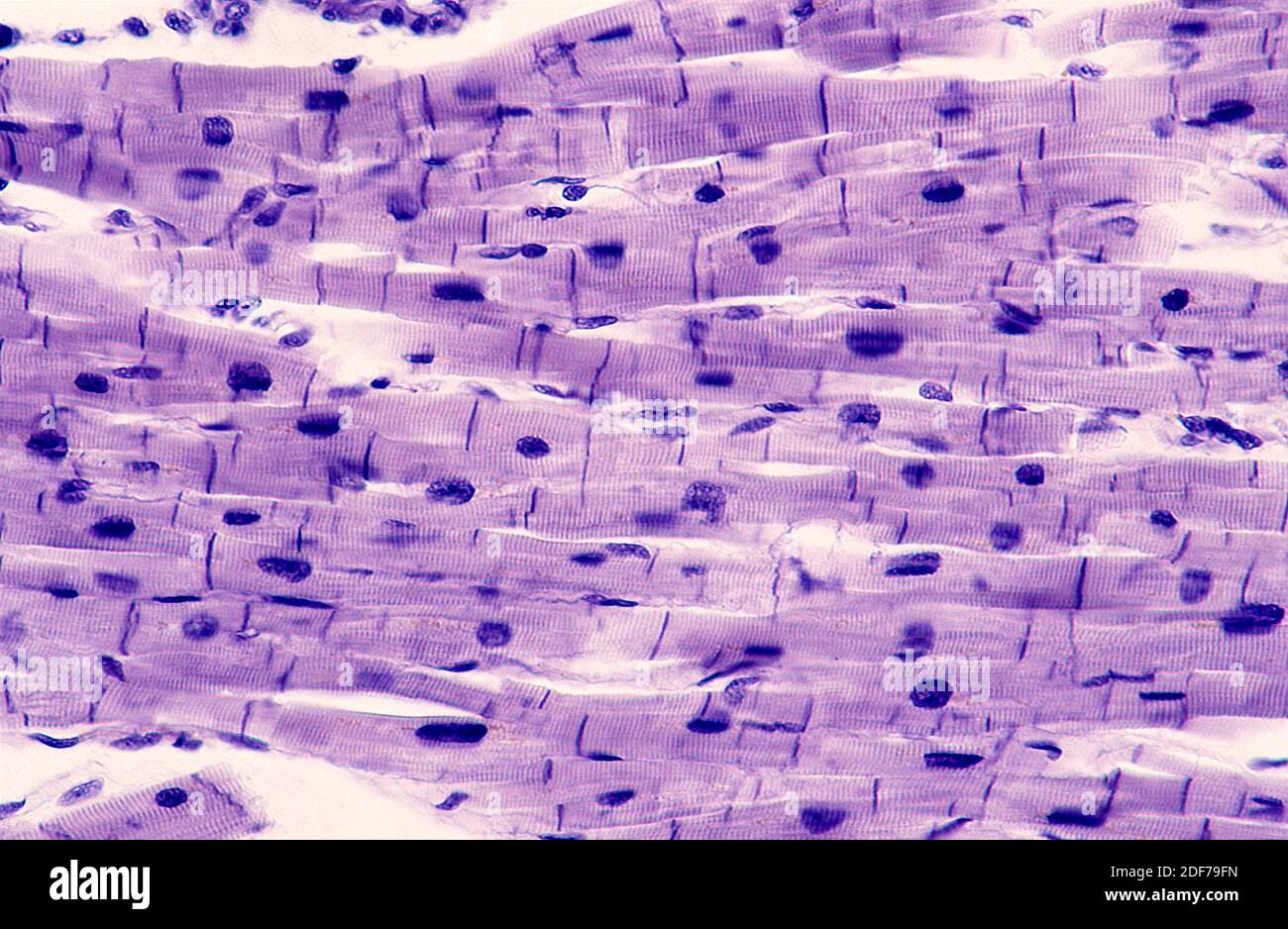 Cardiac muscle showing cells, nucleous and sarcomeres. Photomicrograph. Stock Photo
