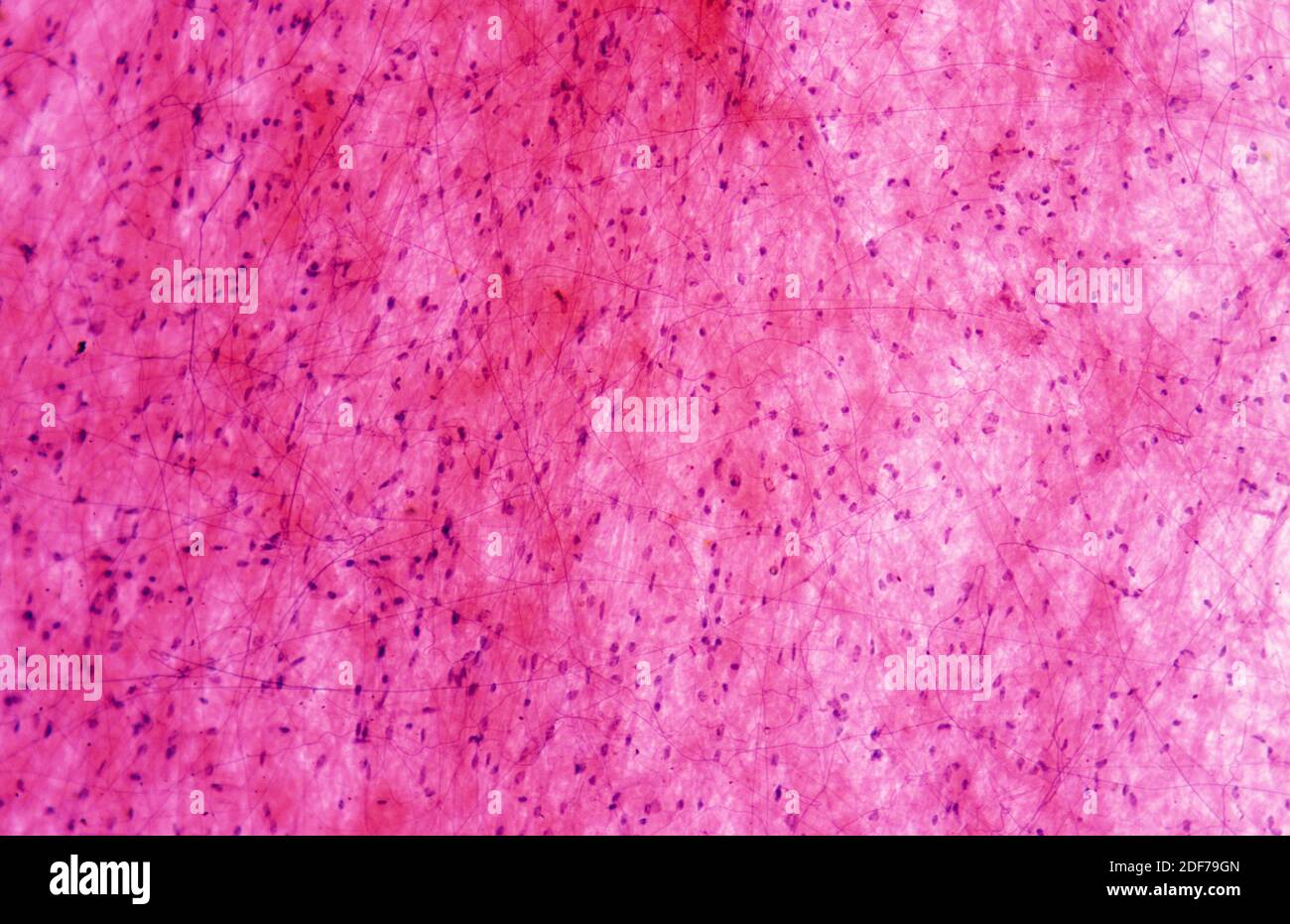 Loose connective tissue showing collagen fibers and fibroblasts. Photomicrograph. Stock Photo