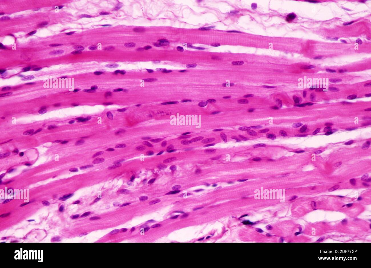 Skeletal muscle, longitudinal section. Photomicrograph. Stock Photo