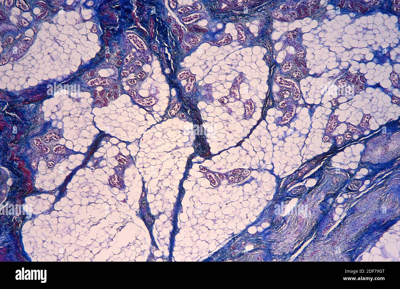 Adipose tissue with blood vessels. Photomicrograph. Stock Photo