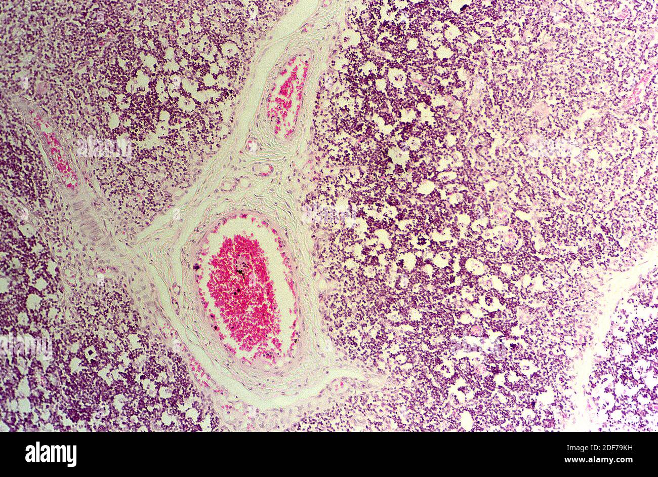 Thymus is a lymphoid organ of the immune system. Photomicrograph. Stock Photo
