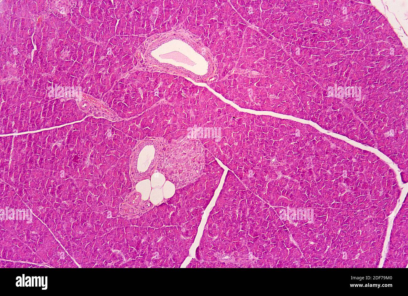 Pancreas is a double gland, endocrine and exocrine. Photomicrograph. Stock Photo