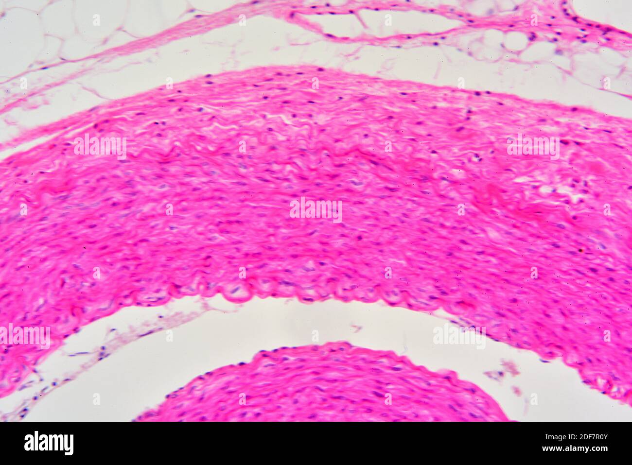 Human artery cross section showing tunica externa, tunica media with smooth muscle fibers and
