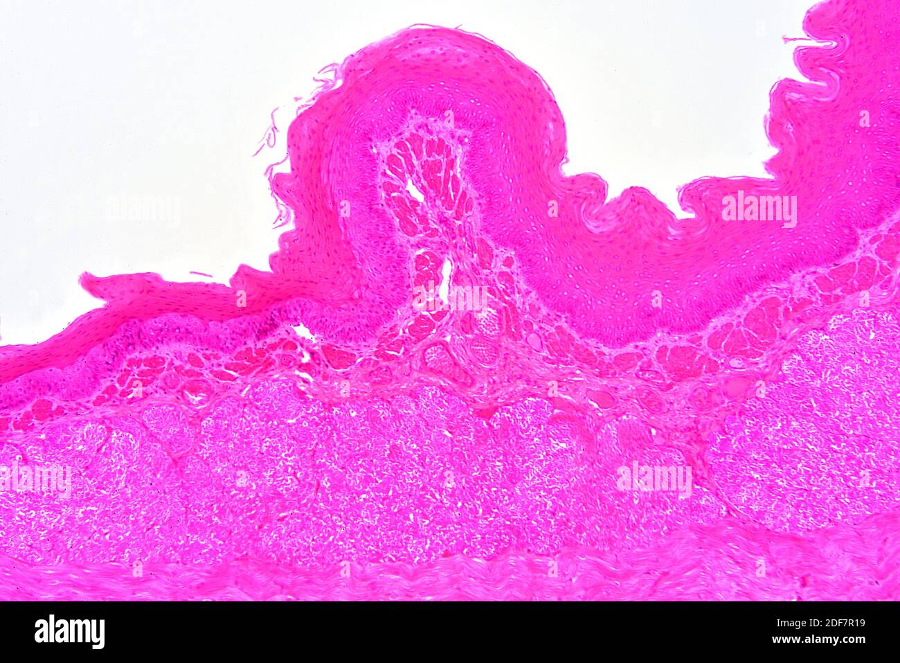 Human esophagus showing non-keratinized stratified squamous epithelium. X75 at 10 cm wide. Stock Photo