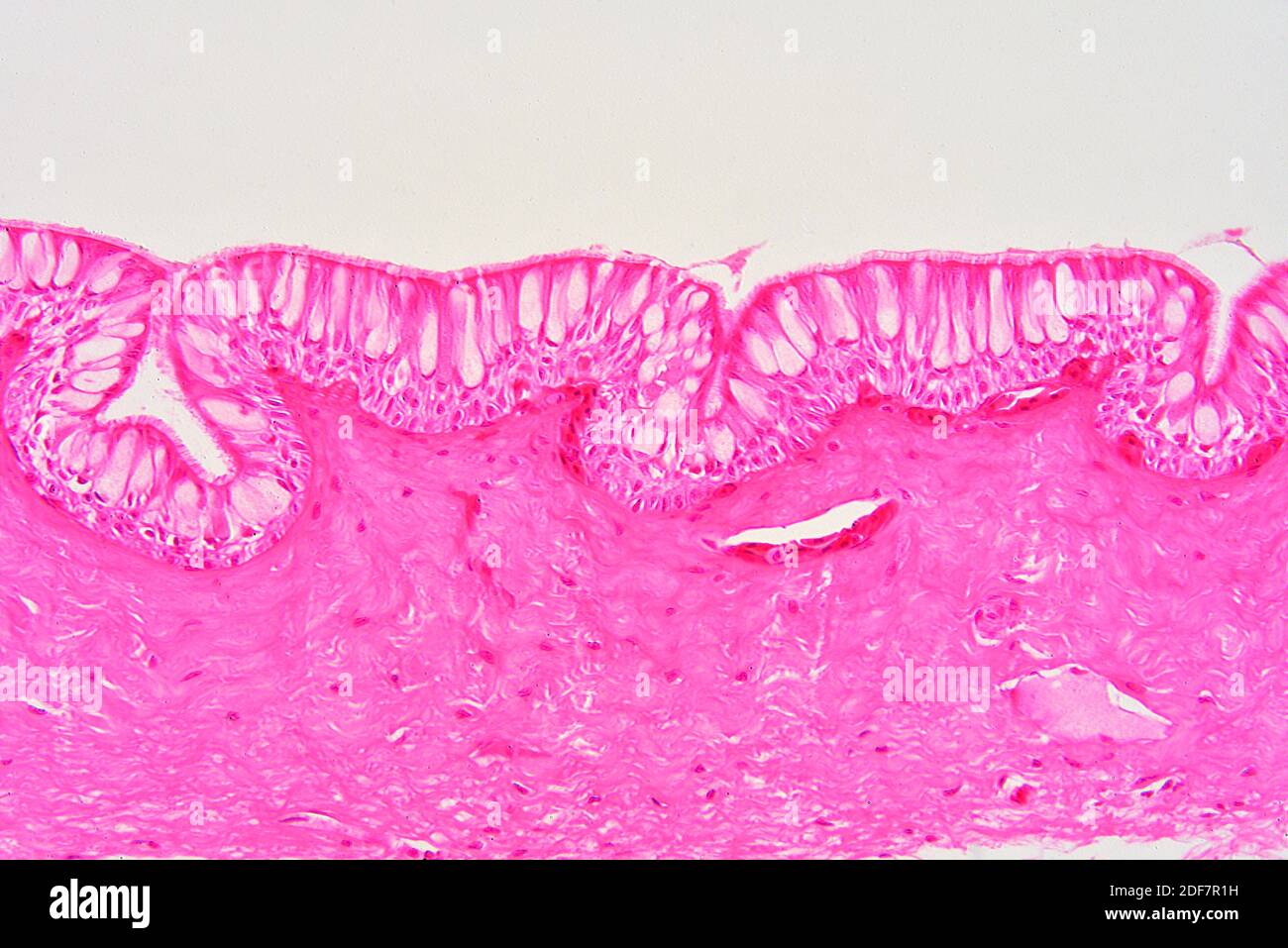 Human columnar ciliated epithelium. X150 at 10 cm wide. Stock Photo