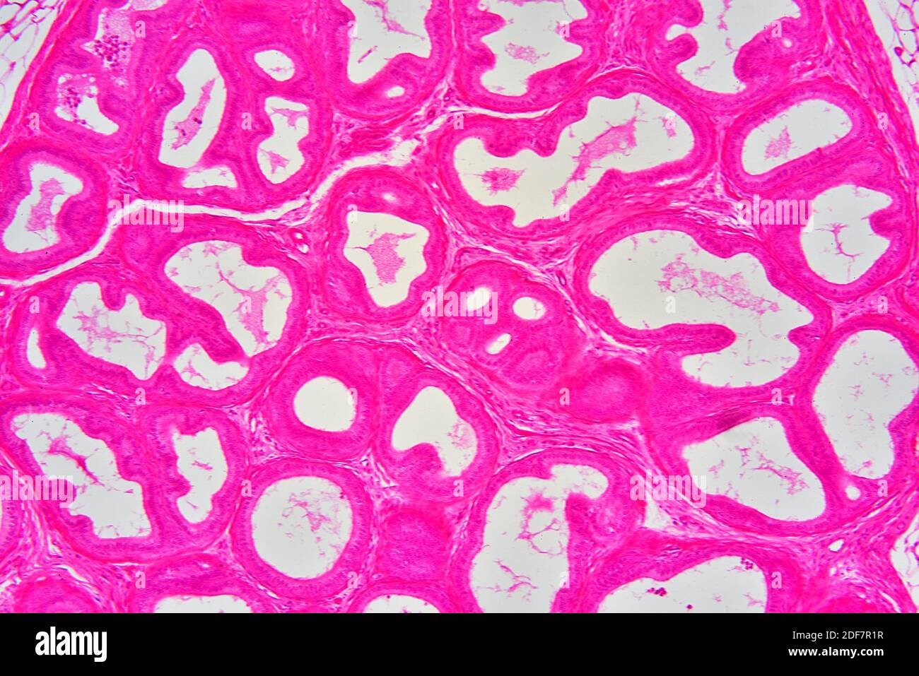 Human epididymis. X75 at 10 cm wide. Stock Photo