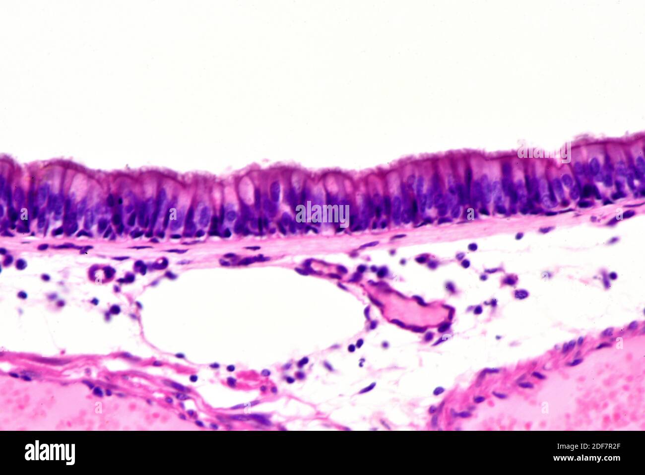 Human ciliated pseudostratified columnar epithelium. X250 at 10 cm wide. Stock Photo