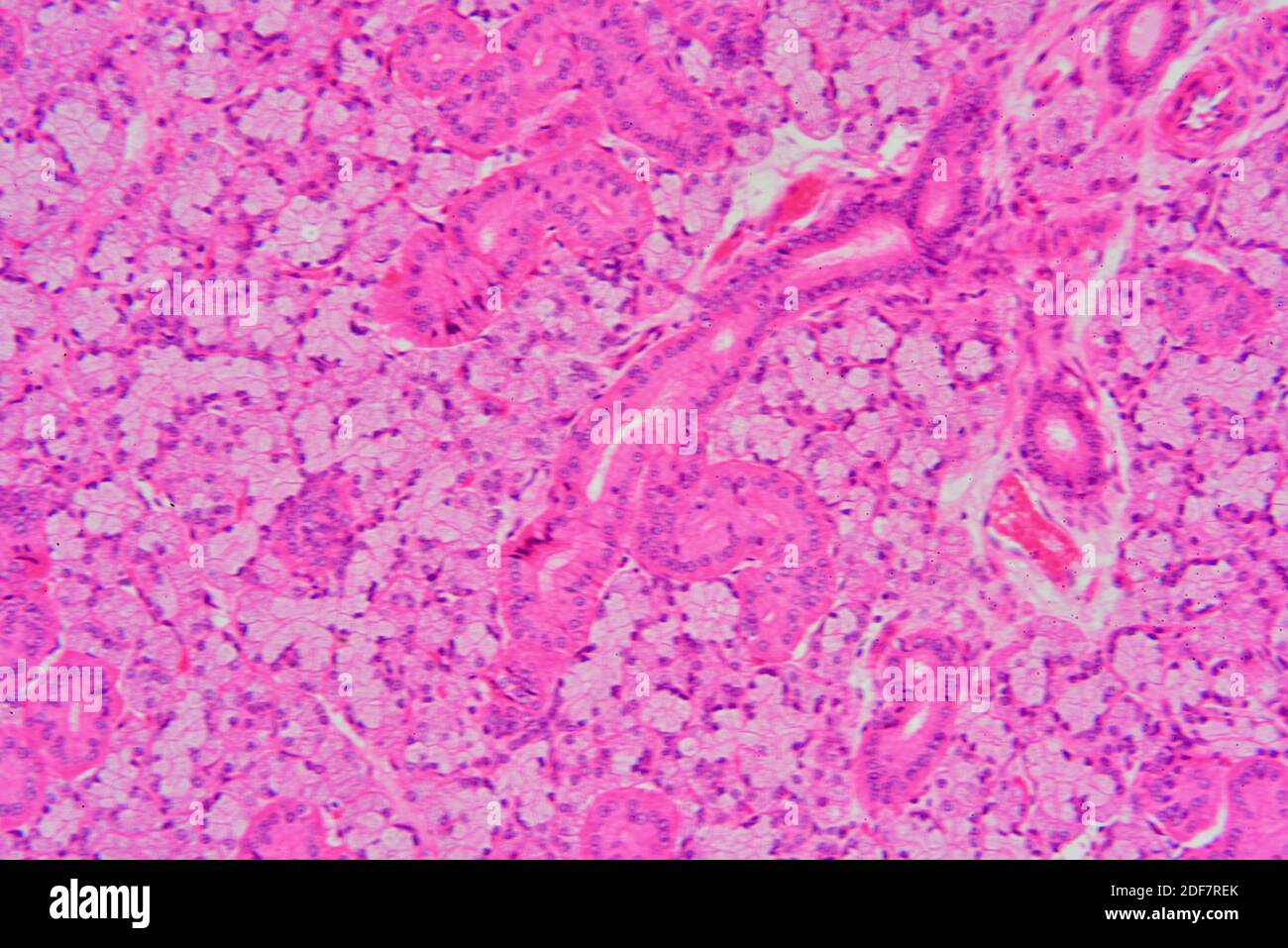 Human salivary gland showing acini, parenchyma, secretory ducts and
