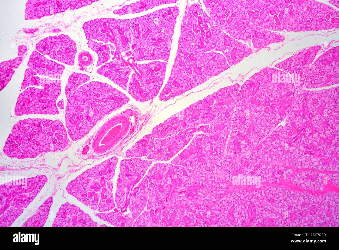 Human salivary gland showing acini, parenchyma, secretory ducts and