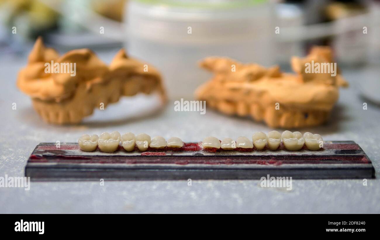 A dental technician makes a prosthesis,teeth sharpening,a block for