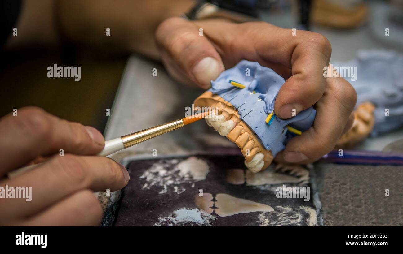 Dental surgeon sculpts dentures,dental plaster model,medical dental