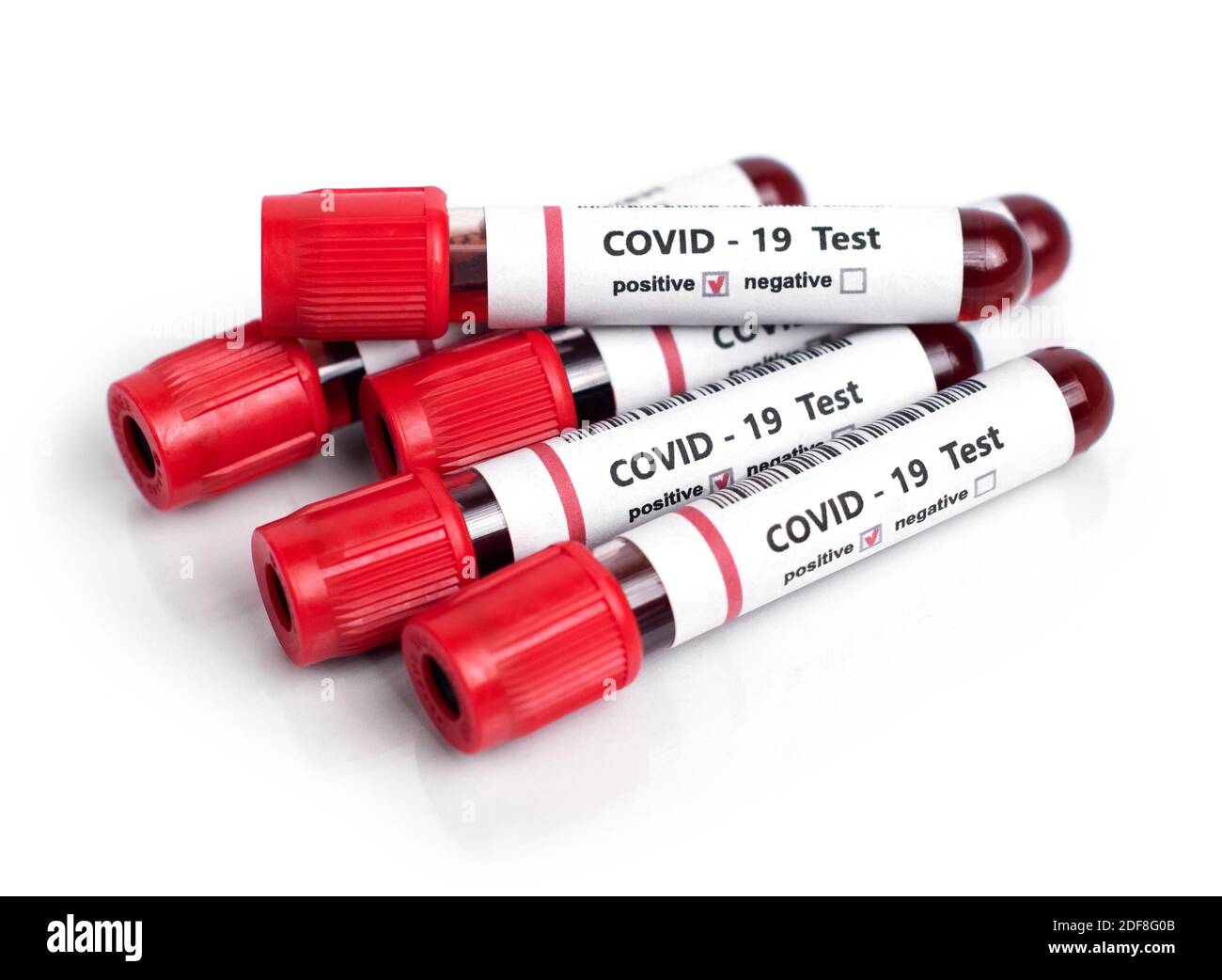Coronavirus tests blood samples on white Stock Photo