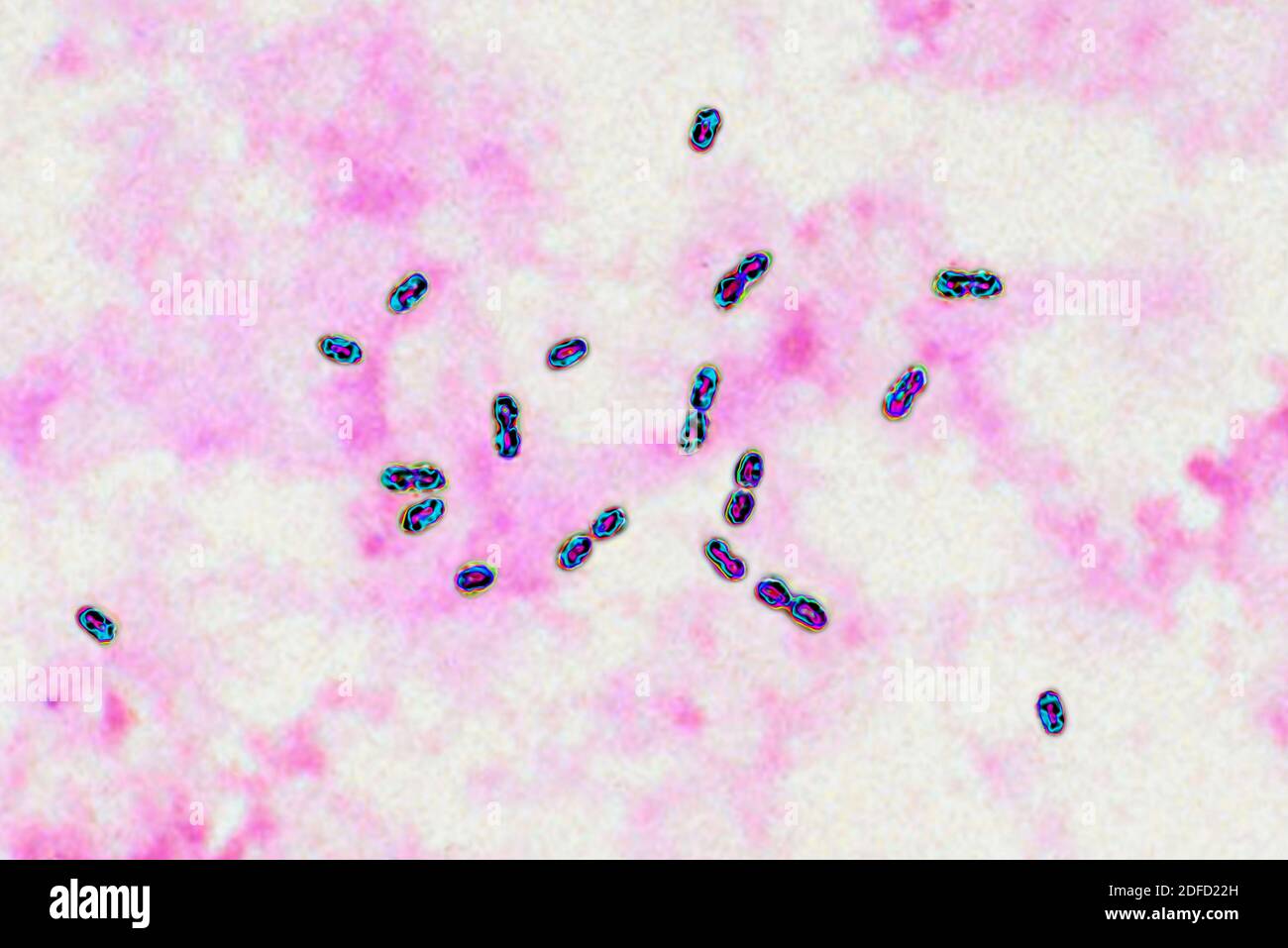 Pneumococcal bacteria Stock Photo
