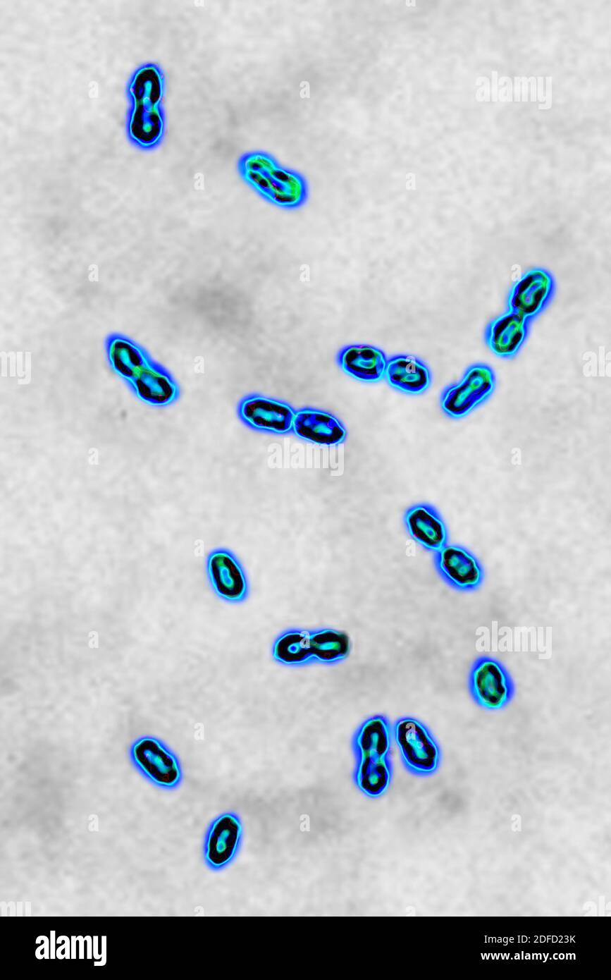 Pneumococcal bacteria Stock Photo