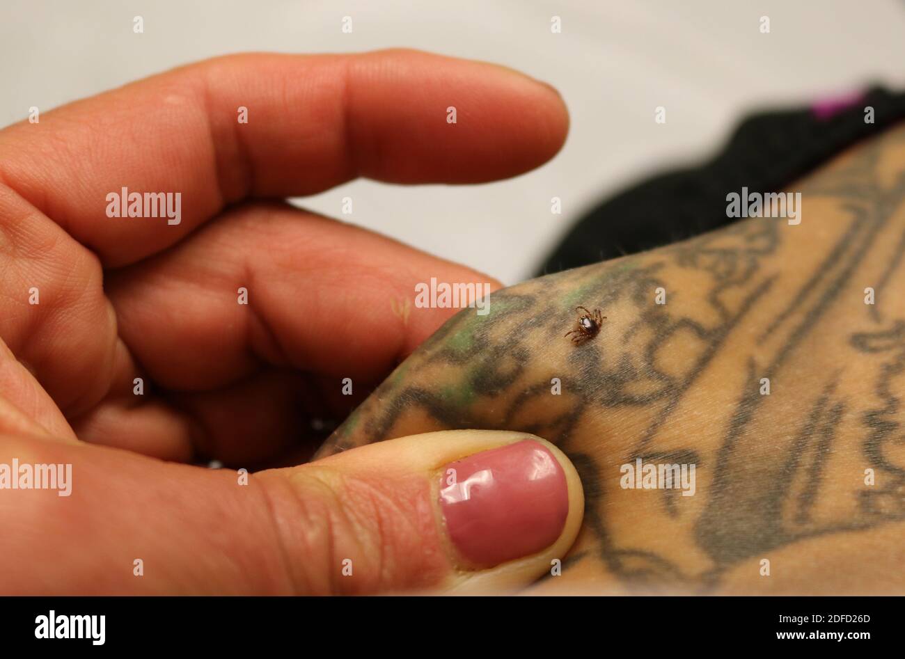 A Maryland woman finds an adult lone star tick, or Amblyomma americanum, on her skin. Lone star ticks can transmit the pathogens that cause diseases s Stock Photo