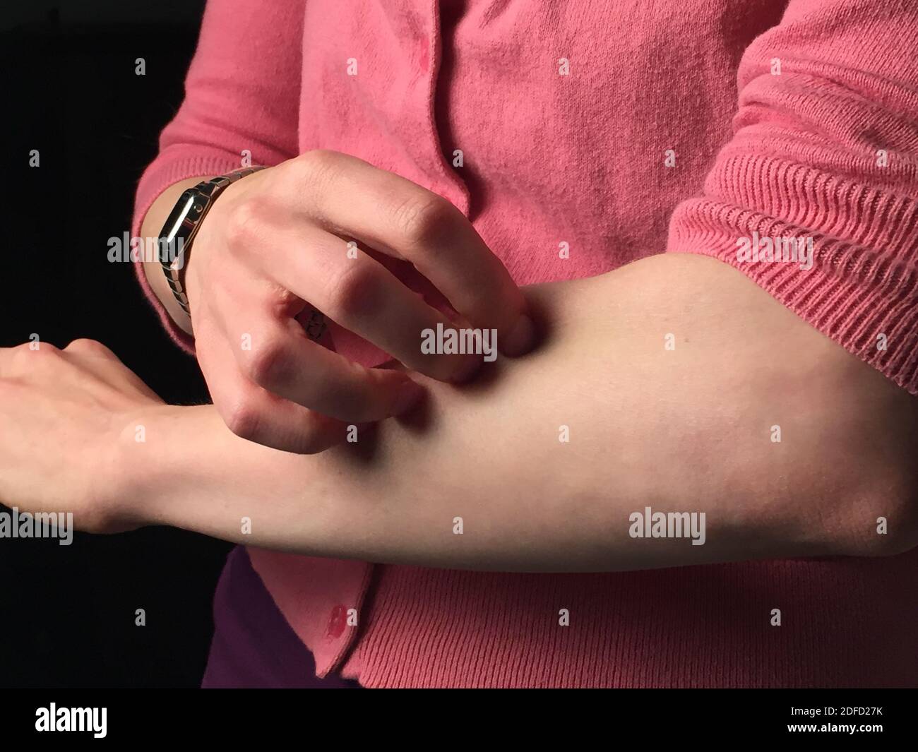 Woman scratching skin Stock Photo
