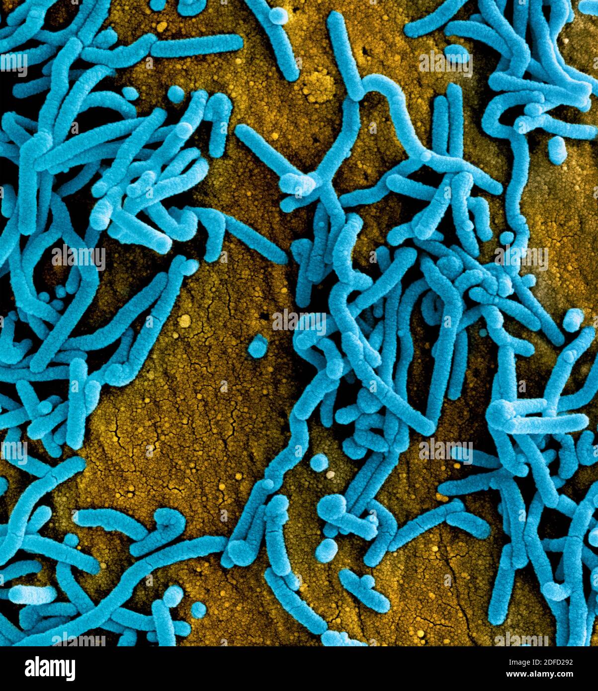 Colorized scanning electron micrograph of Marburg virus particles (blue) both budding and attached to the surface of infected VERO E6 cells (orange). Stock Photo
