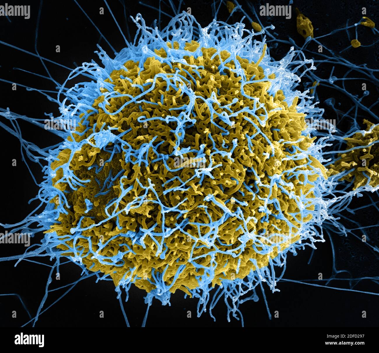 Colorized scanning electron micrograph of filamentous Ebola virus particles (blue) budding from a chronically infected VERO E6 cell (yellow-green). Im Stock Photo