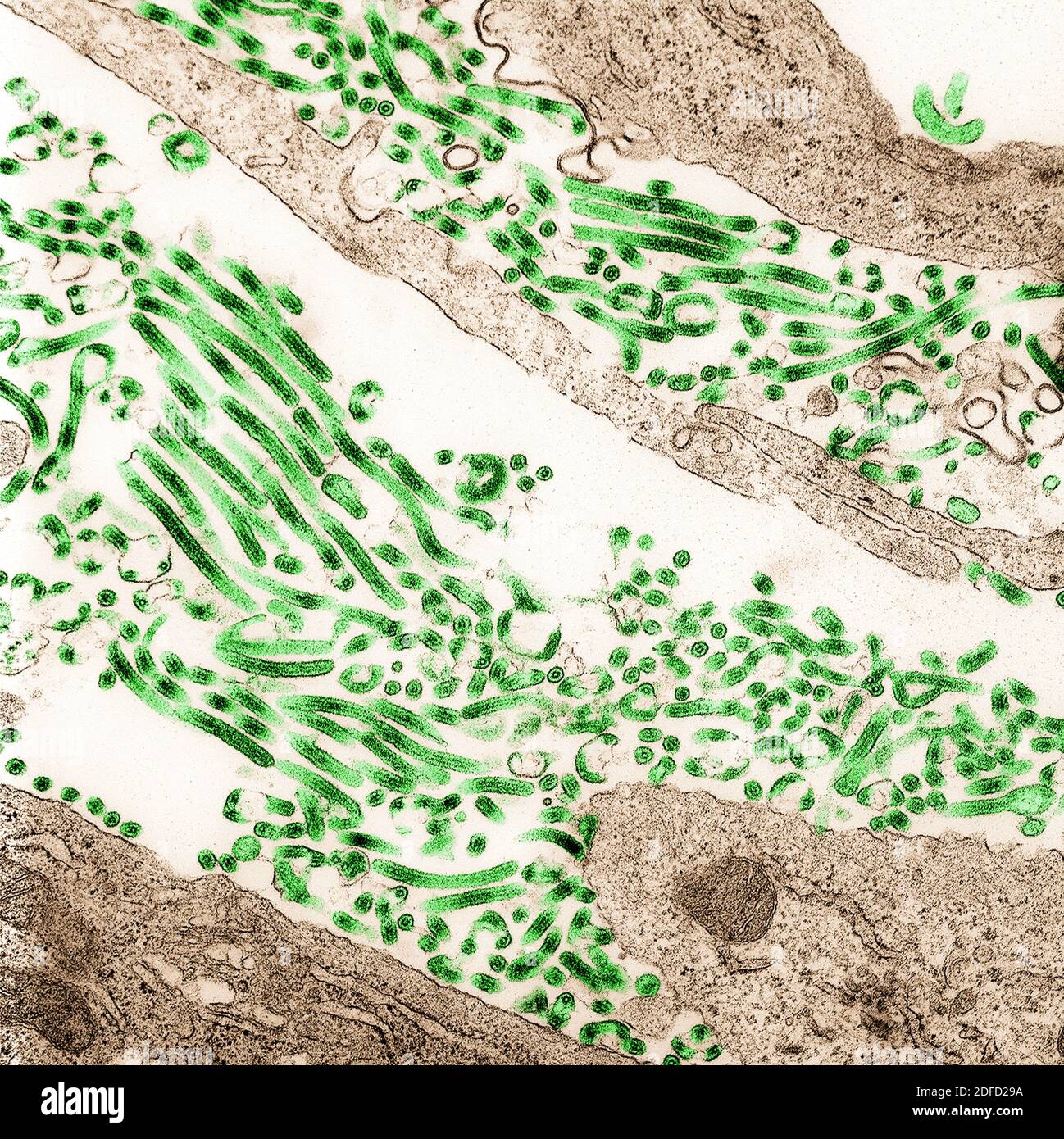 Colorized transmission electron micrograph of Ebola virus particles (green) found both as extracellular particles and budding particles from chronical Stock Photo