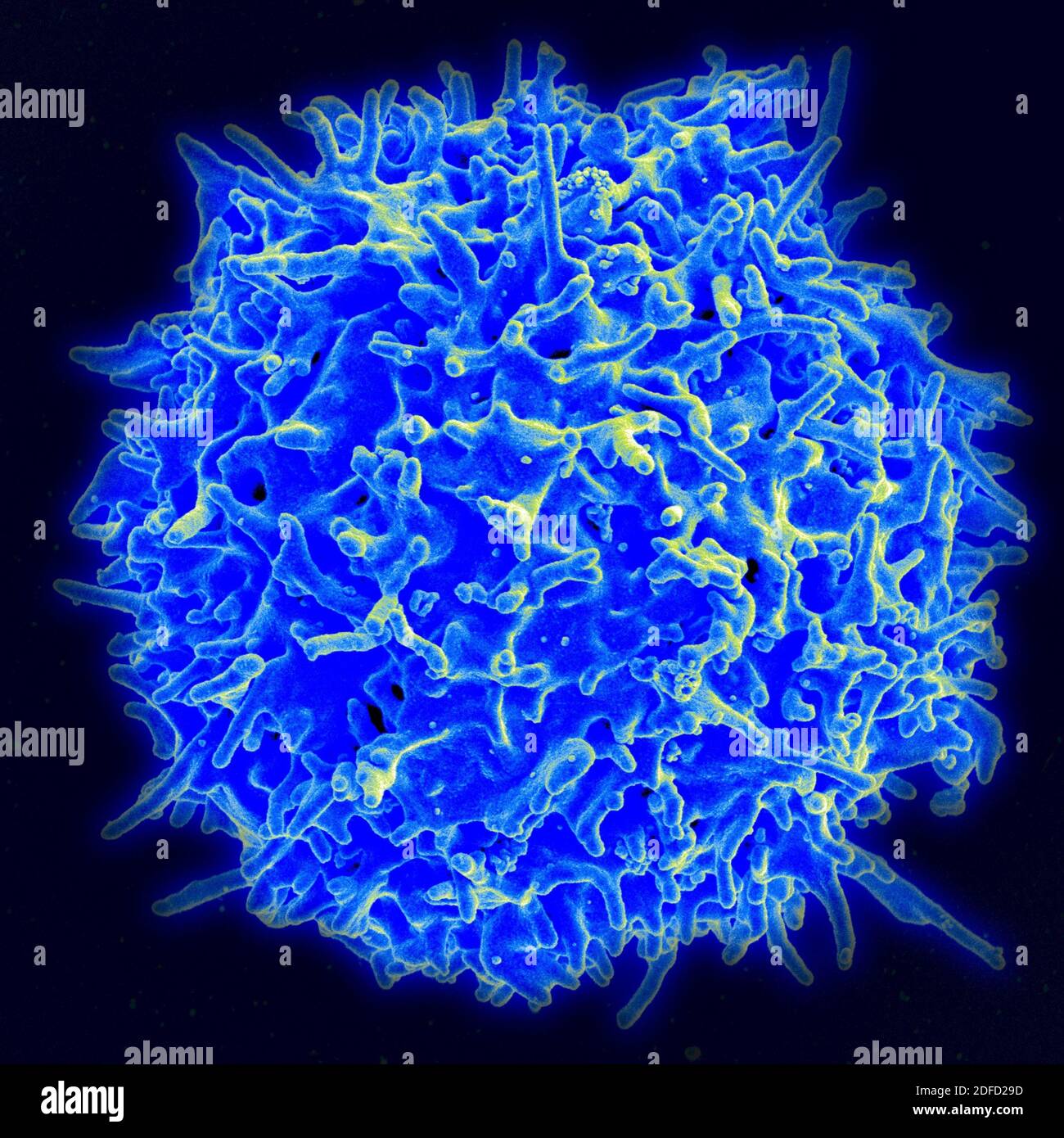 Scanning electron micrograph of a human T lymphocyte (also called a T cell) from the immune system of a healthy donor. Credit: NIAID. Stock Photo