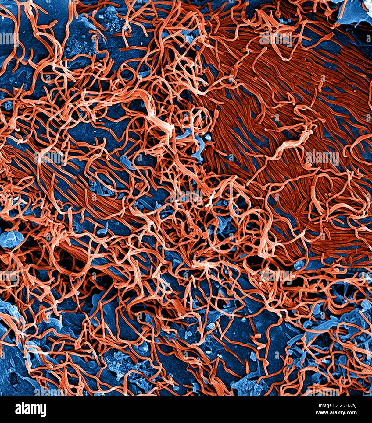 Colorized scanning electron micrograph of filamentous. Ebola virus particles (red) attached and budding from. a chronically infected VERO E6 cell (blu Stock Photo