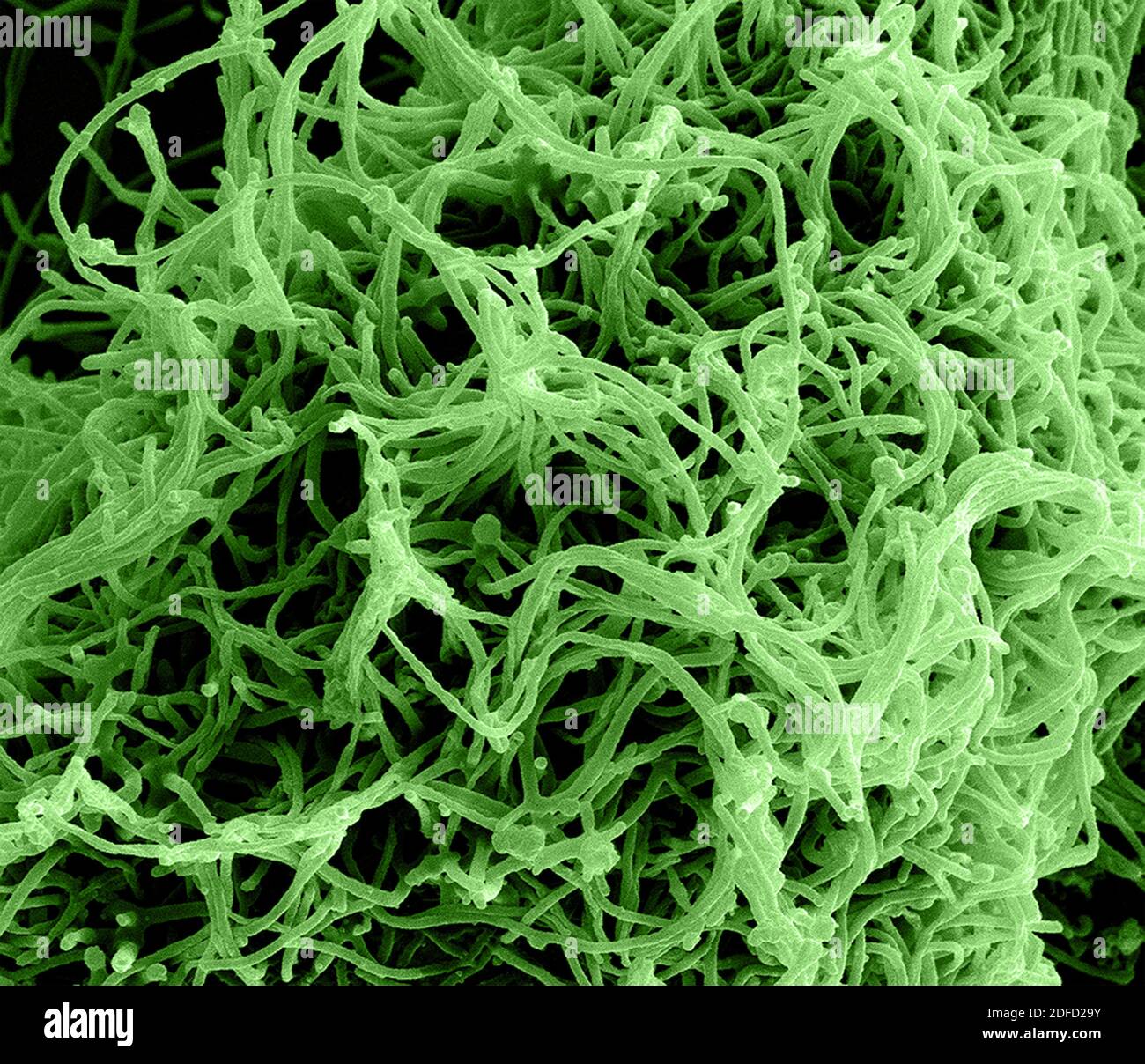 Colorized scanning electron micrograph of filamentous Ebola virus particles budding from a chronically infected VERO E6 cell (35,000x magnification). Stock Photo