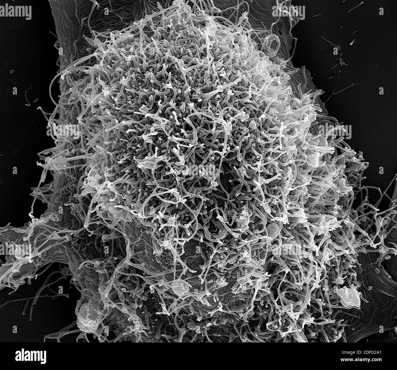 Scanning electron micrograph of filamentous Ebola virus particles attached and budding from chronically infected VERO E6 cells (15,000x magnification) Stock Photo