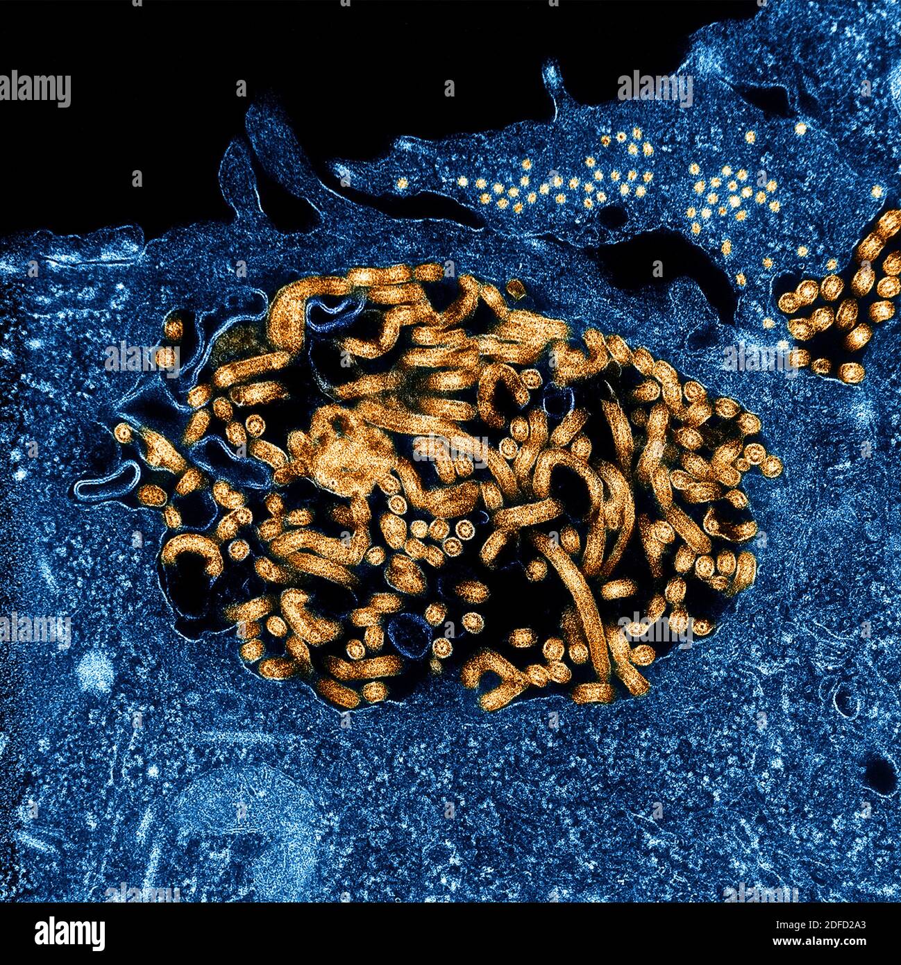 Colorized transmission electron micrograph of Ebola virus nucleocapsids (small orange circles) and virus particles (larger orange filamentous forms) w Stock Photo