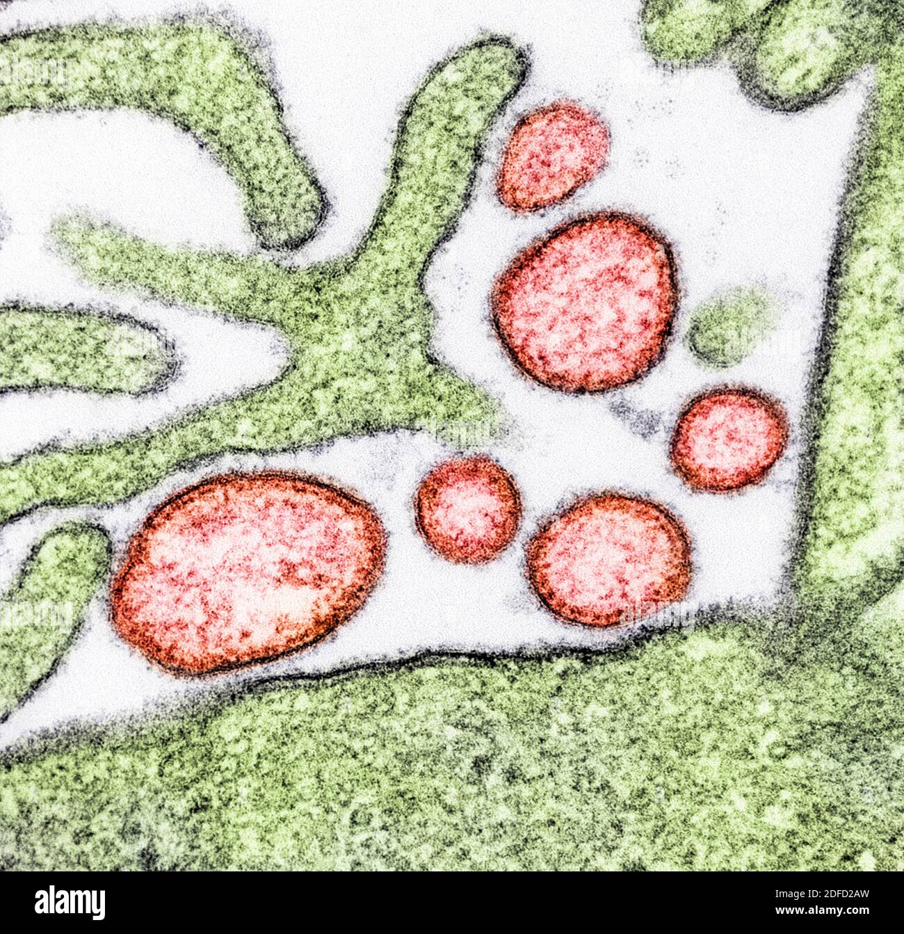 Colorized transmission electron micrograph of mature extracellular Nipah Virus particles (red) near the periphery of an infected VERO cell (green). Im Stock Photo