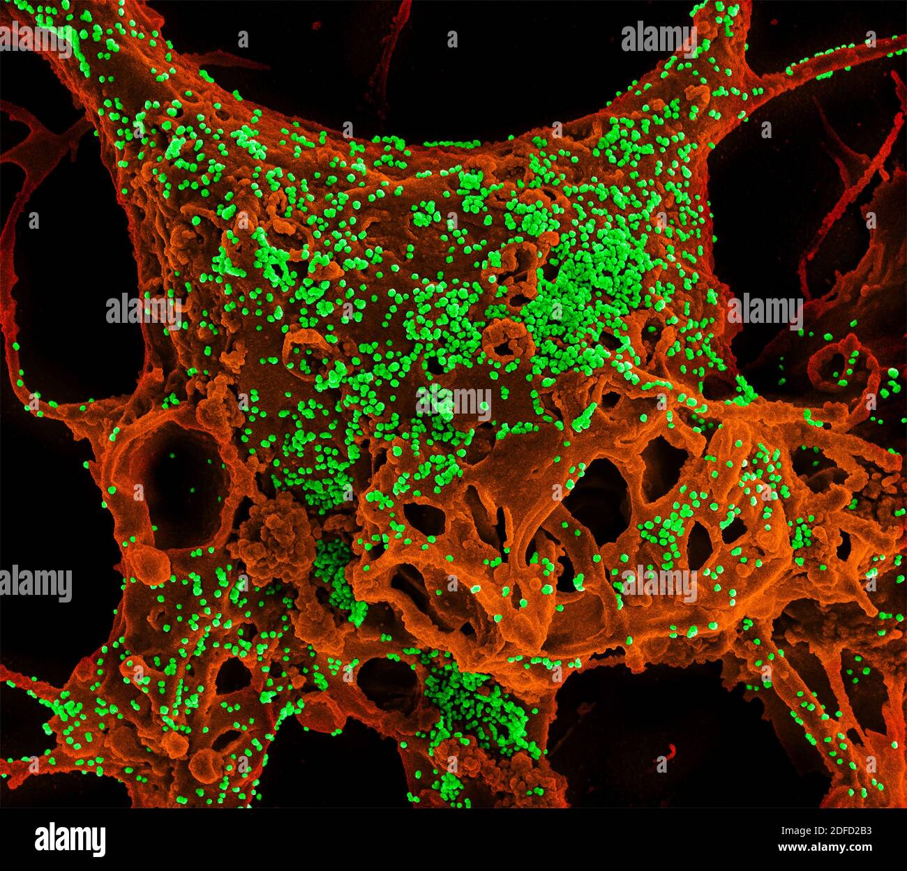 Color-enhanced scanning electron micrograph of Vero E6 cells infected with Middle East respiratory syndrome coronavirus (MERS-CoV). Image captured and Stock Photo