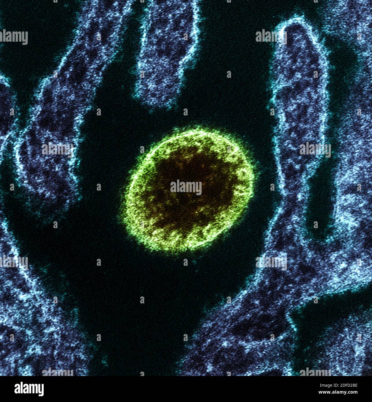 Colorized transmission electron micrograph of a mature extracellular Nipah Virus particle (green) near the periphery of an infected VERO cell (blue). Stock Photo
