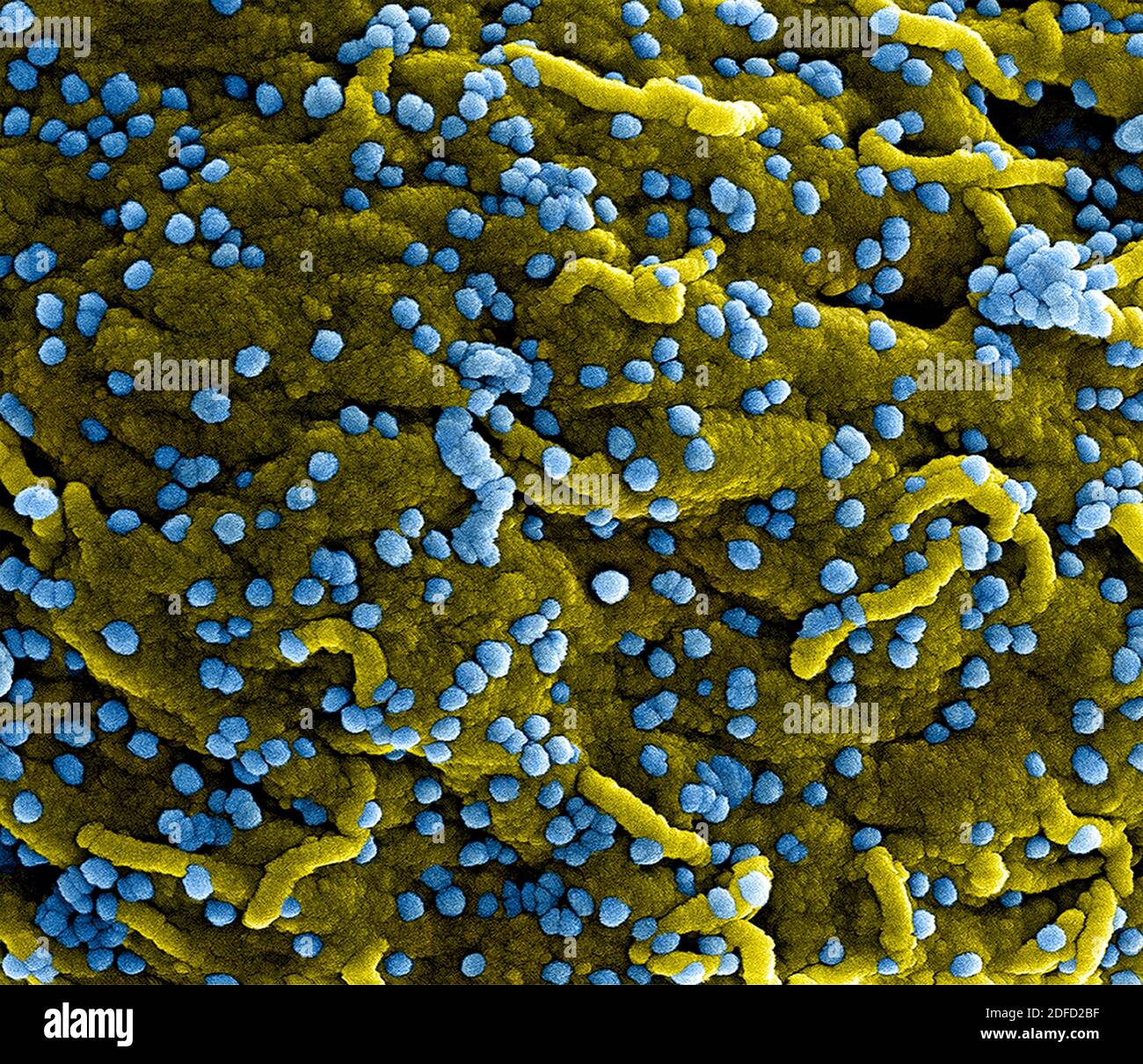 Marburg virus hires stock photography and images Alamy