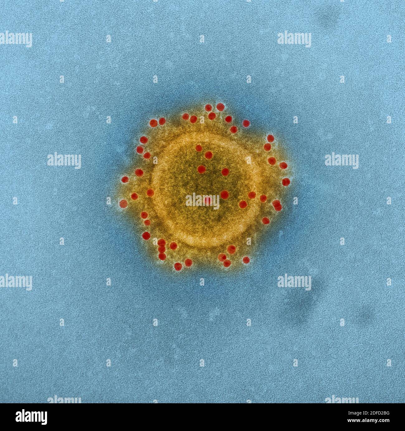 Mers coronavirus particle Stock Photo