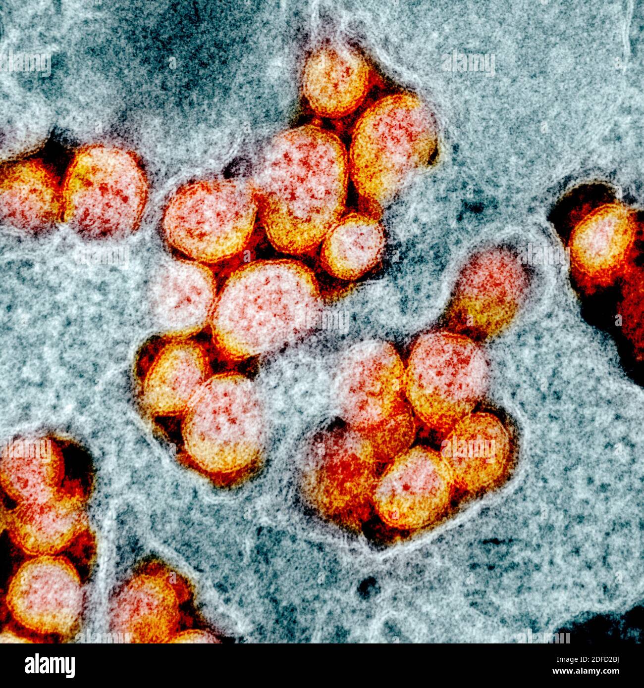 Transmission electron micrograph of SARS-CoV-2 virus particles, isolated from a patient. Image captured and color-enhanced at the NIAID Integrated Res Stock Photo