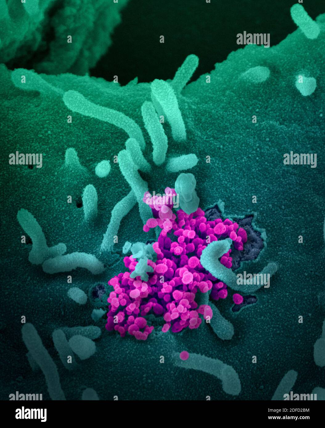 This scanning electron microscope image shows SARS-CoV-2 (round magenta objects) emerging from the surface of cells cultured in the lab. SARS-CoV-2, a Stock Photo