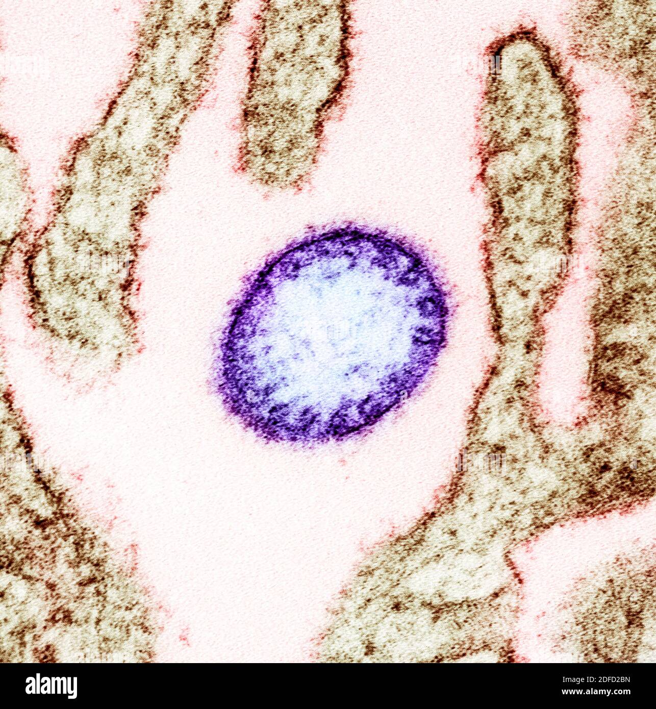 Colorized transmission electron micrograph of a mature extracellular Nipah Virus particle (purple) near the periphery of an infected VERO cell (brown) Stock Photo