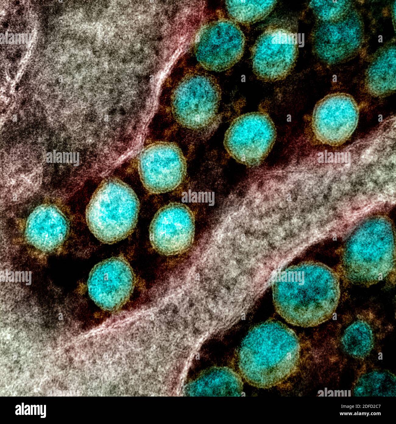 Transmission electron micrograph of SARS-CoV-2 virus particles, isolated from a patient. Image captured and color-enhanced at the NIAID Integrated Res Stock Photo