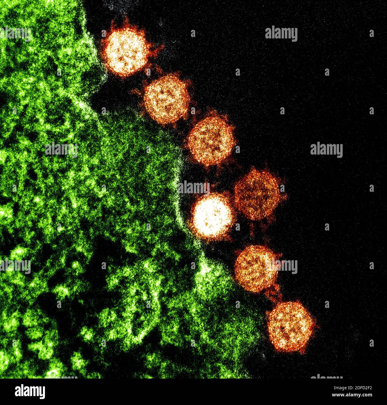 Colorized transmission electron micrograph of Severe Acute Respiratory Syndrome (SARS) virus particles (orange) found near the periphery of an infecte Stock Photo