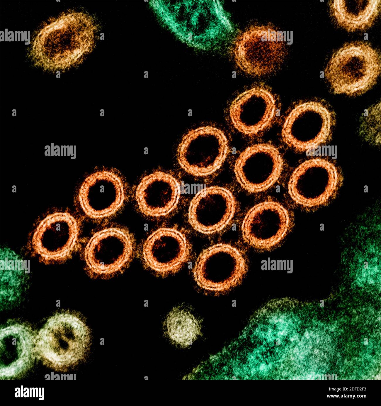 Colorized transmission electron micrograph of a cross-section of SW31 (swine strain) influenza virus particles (orange) found near the surface of an i Stock Photo