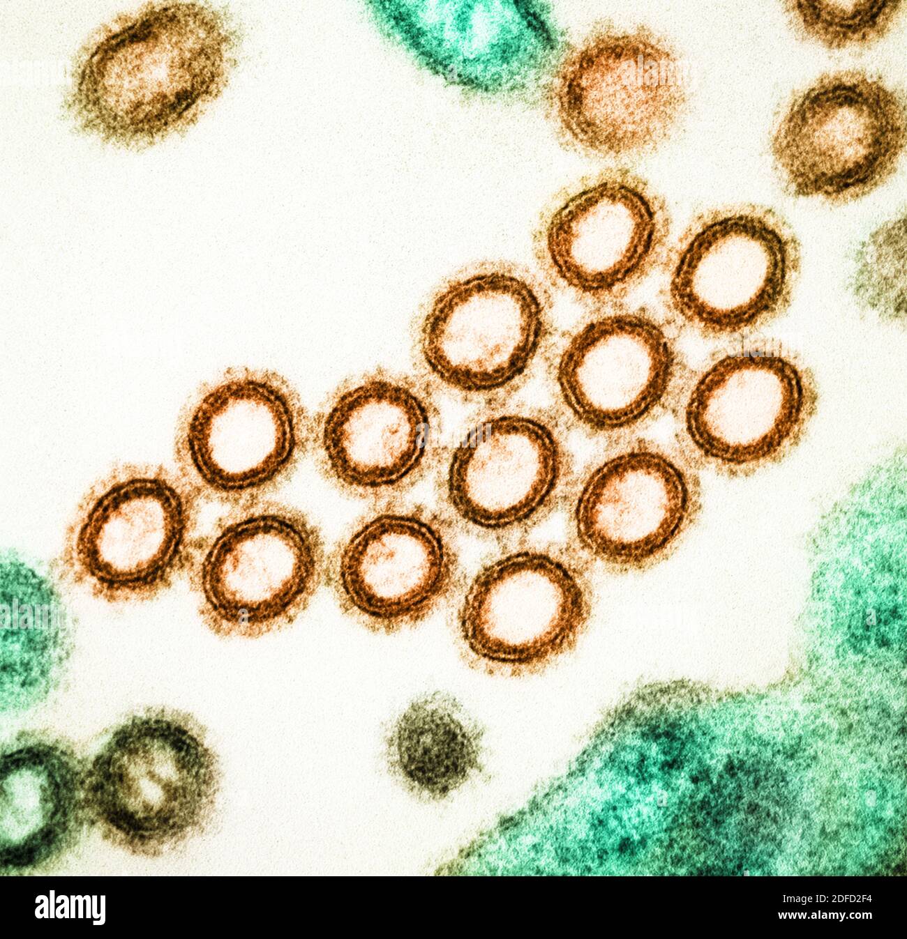 Colorized transmission electron micrograph of a cross-section of SW31 (swine strain) influenza virus particles (orange) found near the surface of an i Stock Photo